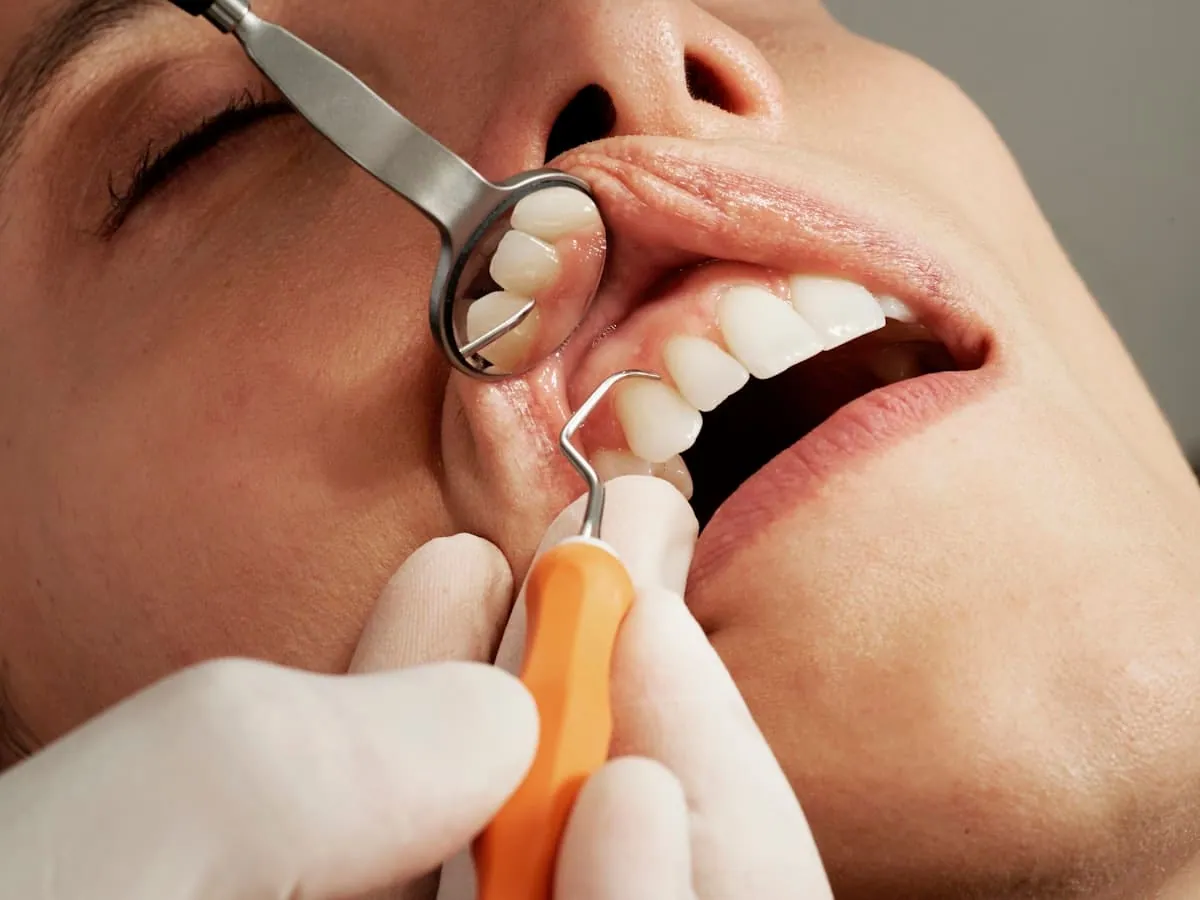 Orthodontie adulte — aligneur et suivi orthodontique